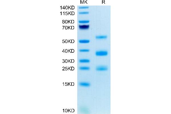 PLAU Protein (AA 21-431) (His tag)