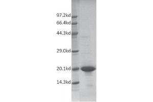 Recombinant TAF1 (1522-1656) protein gel. (TAF1 Protein (AA 1522-1656) (His tag,DYKDDDDK Tag))