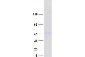 Western Blotting (WB) image for Inositol Polyphosphate-5-Phosphatase K (INPP5K) (Transcript Variant 2) protein (Myc-DYKDDDDK Tag) (ABIN2723489)