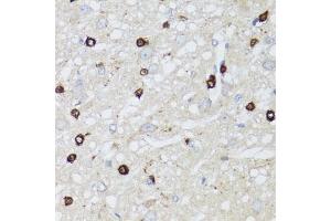 Immunohistochemistry of paraffin-embedded rat brain using MIP antibody (ABIN3016917, ABIN3016918, ABIN3016919 and ABIN6219879) at dilution of 1:100 (40x lens). (Mip (AA 50-150) antibody)