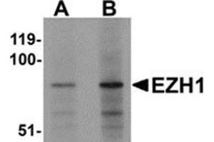Western blot analysis of EZH1 in mouse lung tissue lysate with EZH1 antibody at (A) 1 and (B) 2 μg/ml. (EZH1 antibody  (N-Term))