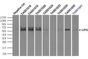 Image no. 2 for anti-Lipase, Endothelial (LIPG) antibody (ABIN1499167) (LIPG antibody)