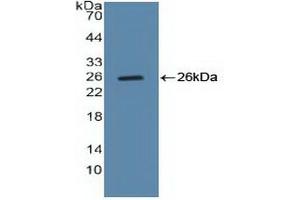 Detection of Recombinant CCNB, Human using Polyclonal Antibody to Cyclin B (CCNB) (Cyclin B1 antibody  (AA 239-433))