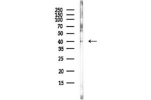 anti-Cyclin-Dependent Kinase 9 (CDK9) (Internal Region) antibody