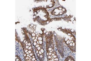 Immunohistochemical staining of human colon with SLC16A1 polyclonal antibody  shows strong cytoplasmic and membranous positivity in glandular cells at 1:500-1:1000 dilution.