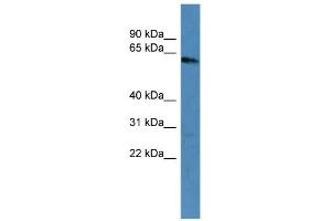 WB Suggested Anti-KRT3 Antibody Titration: 0. (Keratin 3 antibody  (C-Term))