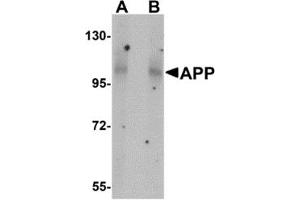 Western Blotting (WB) image for anti-Amyloid beta (A4) Precursor Protein (APP) (N-Term) antibody (ABIN1031238) (APP antibody  (N-Term))