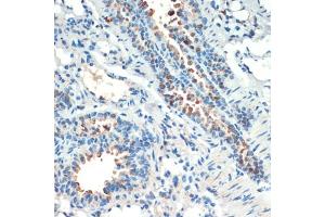 Immunohistochemistry of paraffin-embedded mouse lung using RPS6K antibody (ABIN6129296, ABIN6147232, ABIN6147233 and ABIN6214270) at dilution of 1:200 (40x lens). (MSK2 antibody  (AA 1-220))
