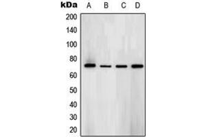 Western blot analysis of SYK (pY323) expression in BJAB (A), Ramos (B), NAMALWA (C), Raw264. (SYK antibody  (pTyr323))