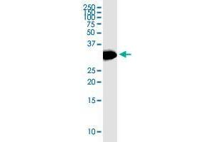 HSD17B12 monoclonal antibody (M08), clone 4G11. (HSD17B12 antibody  (AA 203-271))