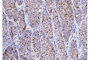 IHC analysis of Cdk2 using anti-Cdk2 antibody (ABIN7602522). (CDK2 antibody  (AA 81-298))