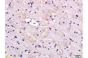 Formalin-fixed and paraffin embedded rat brain labeled with Anti GPR55 Polyclonal Antibody, Unconjugated (ABIN872750) at 1:200 followed by conjugation to the secondary antibody and DAB staining. (GPR55 antibody  (AA 141-240))
