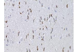 Immunohistochemistry of paraffin-embedded mouse brain using NGF antibody (ABIN6293296) at dilution of 1:75 (40x lens). (Nerve Growth Factor antibody)