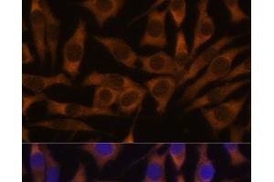 Immunofluorescence analysis of L929 cells using IGF2BP3 Polyclonal Antibody at dilution of 1:100. (IGF2BP3 antibody)