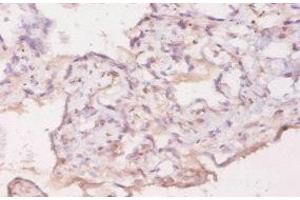Immunohistochemistry of paraffin-embedded human placenta tissue using ABIN7177253 at dilution of 1:20 (GDF5 antibody  (AA 376-495))