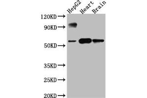 Western Blot Positive WB detected in: HepG2 whole cell lysate, Rat Heart whole cell lysate, Rat Brain whole cell lysate All lanes: CYP17A1 antibody at 1:1000 Secondary Goat polyclonal to rabbit IgG at 1/50000 dilution Predicted band size: 58 kDa Observed band size: 58 kDa (Recombinant CYP17A1 antibody)
