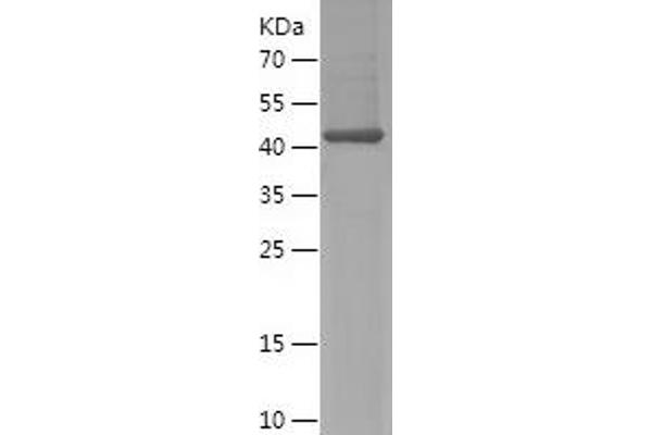 SH3BP4 Protein (AA 615-963) (His tag)