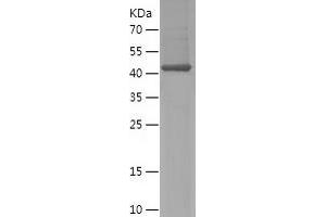 Western Blotting (WB) image for SH3-Domain Binding Protein 4 (SH3BP4) (AA 615-963) protein (His tag) (ABIN7283308) (SH3BP4 Protein (AA 615-963) (His tag))