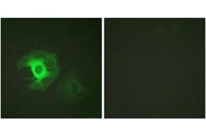 Immunofluorescence analysis of HeLa cells, using Caldesmon (Ab-789) Antibody.