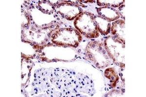 CD70 antibody immunohistochemistry analysis in formalin fixed and paraffin embedded human kidney tissue. (CD70 antibody  (AA 72-101))
