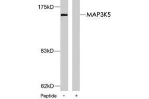 Western blot analysis of extract from MDA-MB-435 cells, using MAP3K5 polyclonal antibody . (ASK1 antibody)