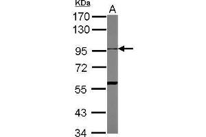 WB Image Sample (30 ug of whole cell lysate) A: THP-1 7. (ADAM10 antibody)