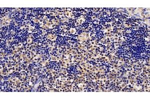 Detection of STAT1 in Human Lymph node Tissue using Polyclonal Antibody to Signal Transducer And Activator Of Transcription 1 (STAT1) (STAT1 antibody  (AA 343-602))