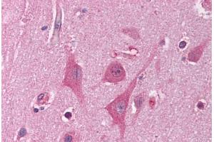 Human Brain, Cortex (formalin-fixed, paraffin-embedded) stained with HNRPUL1 antibody ABIN214114 at 5 ug/ml followed by biotinylated goat anti-rabbit IgG secondary antibody ABIN481713, alkaline phosphatase-streptavidin and chromogen. (HNRNPUL1 antibody  (AA 48-97))