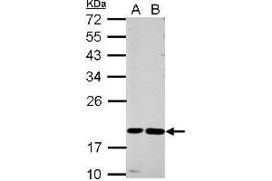 WB Image Sample (30 ug of whole cell lysate) A: A549 B: MCF-7 12% SDS PAGE antibody diluted at 1:1000 (CST7 antibody)