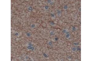 Used in DAB staining on fromalin fixed paraffin- embedded Kidney tissue (IL20RA antibody  (AA 269-545))