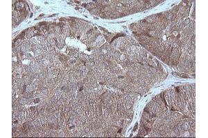 Image no. 1 for anti-Mitogen-Activated Protein Kinase Kinase 1 (MAP2K1) antibody (ABIN1499381) (MEK1 antibody)