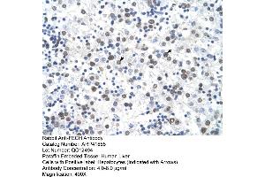 Rabbit Anti-FECH Antibody  Paraffin Embedded Tissue: Human Liver Cellular Data: Hepatocytes Antibody Concentration: 4.