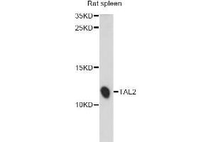 Western blot analysis of extracts of rat spleen, using TAL2 antibody (ABIN6292514) at 1:1000 dilution. (TAL2 antibody)