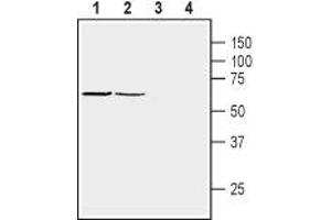 Western Blotting (WB) image for anti-Syntrophin, beta 1 (Dystrophin-Associated Protein A1, 59kDa, Basic Component 1) (SNTB1) (AA 99-113), (Intracellular) antibody (ABIN7043798)