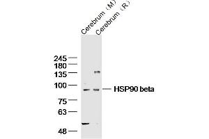 Lane 1: mouse cerebrum lysates Lane 2: rat cerebrum lysates probed with HSP90 beta Polyclonal Antibody, Unconjugated  at 1:300 dilution and 4˚C overnight incubation. (HSP90AB1 antibody  (AA 635-724))