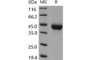 Western Blotting (WB) image for Fc Fragment of IgE, Low Affinity II, Receptor For (CD23) (FCER2) protein (His tag) (ABIN7195673) (FCER2 Protein (His tag))