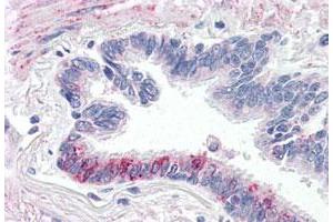 Immunohistochemistry (Formalin/PFA-fixed paraffin-embedded sections) of human lung, respiratory epithelium with F2RL3 polyclonal antibody . (F2RL3 antibody  (C-Term))