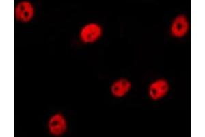 ABIN6275260 staining Hela by IF/ICC. (MLF1 antibody  (Internal Region))