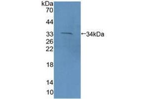 Western blot analysis of recombinant Mouse PCDH15. (PCDH15 antibody  (AA 45-270))