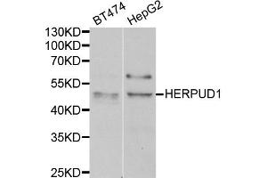 Western blot analysis of extracts of BT474 and HepG2 cell lines, using HERPUD1 antibody. (HERPUD1 antibody)