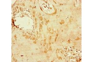 Immunohistochemistry of paraffin-embedded human placenta tissue using ABIN7150406 at dilution of 1:100 (CCDC111 antibody  (AA 305-537))