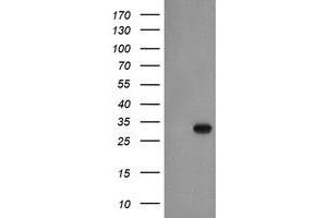 Western Blotting (WB) image for anti-Exosome Component 3 (EXOSC3) antibody (ABIN1498138) (EXOSC3 antibody)