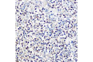 Immunohistochemistry of paraffin-embedded human spleen using CD80 Rabbit pAb (ABIN7266220) at dilution of 1:100 (40x lens). (CD80 antibody  (AA 1-100))