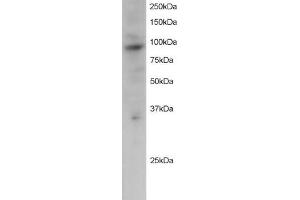 Western Blotting (WB) image for anti-PML-RARA Regulated Adaptor Molecule 1 (PRAM1) (C-Term) antibody (ABIN2466137) (PRAM1 antibody  (C-Term))