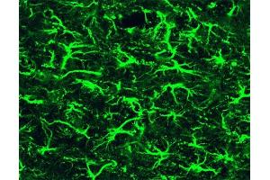 Immunofluorescence staining of a mouse brain section. (GFAP antibody)