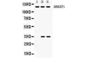 Western blot analysis of ARHGEF1 expression in rat brain extract ( Lane 1), HELA whole cell lysates ( Lane 2) and JURKAT whole cell lysates ( Lane 3). (ARHGEF1 antibody  (N-Term))