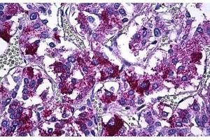 Human Adrenal Medulla: Formalin-Fixed, Paraffin-Embedded (FFPE) (IRS1 antibody  (AA 289-338))