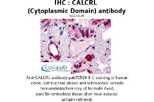 Image no. 1 for anti-Calcitonin Receptor-Like (CALCRL) antibody (ABIN1732562) (CALCRL antibody)