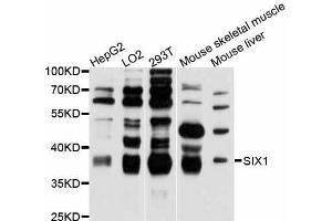 Western blot analysis of extracts of various cell lines, using SIX1 antibody (ABIN5998814) at 1:3000 dilution. (SIX Homeobox 1 antibody)