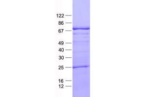 LZTS1 Protein (His tag)